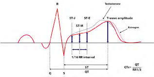 Image result for J Point