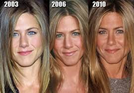 Wird sie jetzt zur frau flodder? Beautiful Nose Job For The Gorgeous Jennifer Aniston Http Www Ourexperiencecounts Com Cosmetic Su Prominente Plastische Chirurgie Plastische Chirurgie Botox
