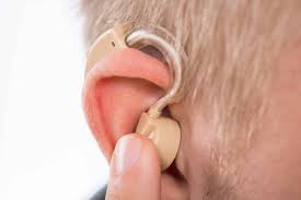 How To Get Va Disability For Hearing Loss Va Claims Insider