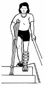 12 Tips For Stair Climbing With Crutches Crutches Walking Up Stairs Walking Stairs