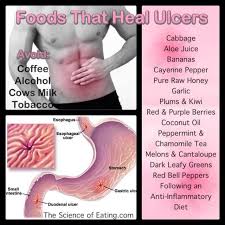 Foods That Heal Ulcers Ulcer Diet Foods For Ulcers Stomach Ulcer Remedies