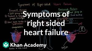 Image result for Right Heart Failure