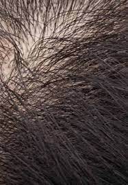 Black dots on the skin can show up as a sign of liver damage. Infections Infestations And Neoplasms Of The Scalp Intechopen