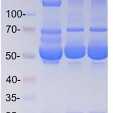 Fetal Bovine Serum Albumin Inhibits Antimicrobial Peptide Activity And  Binds Drug Only In Complex With Α1-Antitrypsin | Scientific Reports