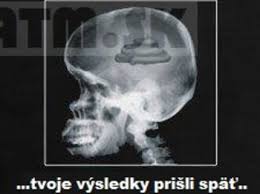 Taktiež to celé nemusí dávať zmysel ale tak to dopadá keď. Aj Tak Vies Iba VeÄ¾ke Hovno D Bratm Sk