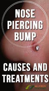 Nase Piercing Bump Ursachen Und Behandlungen Nase Piercing Allergiesymptome Akne Nasen Piercing Nasenpiercing