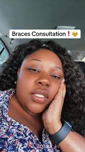 Getting Braces as an Adult: My Personal Journey