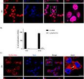 Thymoquinone chemically conjugated to doxorubicin: antitumor ...