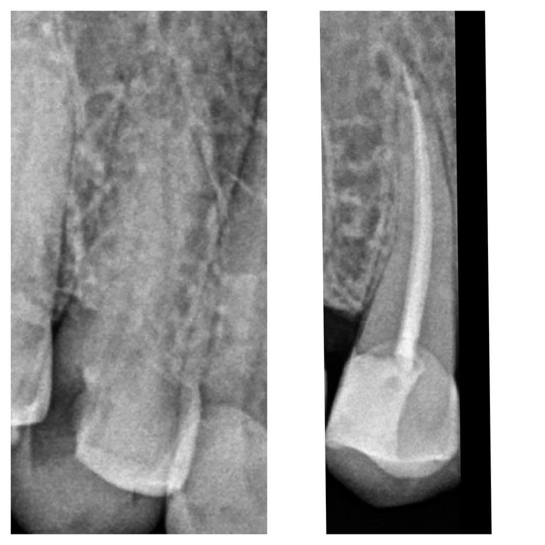 Dental X-ray(RVG) product image