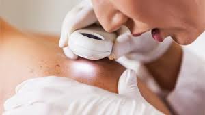 The skin cancer foundation estimates doctors diagnosed ov. Superficial Radiation Therapy A Non Surgical Treatment For Non Melanoma Skin Cancers Technology Networks