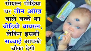 Baby Born With 3 Eyes In Germany Let S Separate Fact From Fiction Youtube
