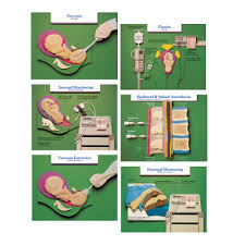 Educational Episiotomy Paper Chart Childbirth Graphics