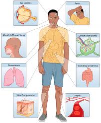 For controlling the outbreak smallpox vaccine, antivirals, and vaccinia immune globin (vig) can be used. Viruses Free Full Text Improving The Care And Treatment Of Monkeypox Patients In Low Resource Settings Applying Evidence From Contemporary Biomedical And Smallpox Biodefense Research Html