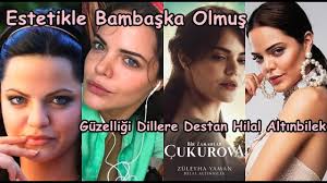 Http Www 15 Temmuz Net Cukurova Nin Zuleyha Si Estetik Harikasiymis Hilal Altinbilek Eski Haline Bakin 6272