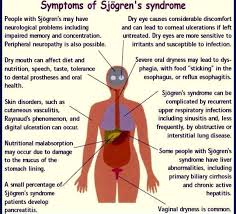Pin On Sjogren S Disease