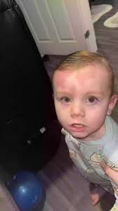 British mum horrified after toddler covered in 'red swollen welts' minutes  after bathing him with baby shampoo