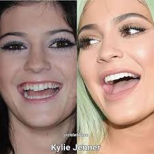 Ines Cavassim Wolf (@draineswolf) • Instagram photos and videos