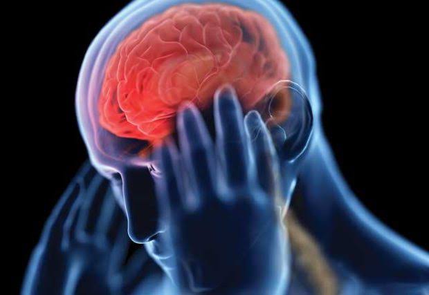 Could this be a stroke? | Wellington Regional Medical Center