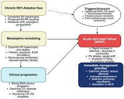 Image result for Right Heart Failure