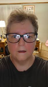 Explant Recovery and Vibration Plate Experience