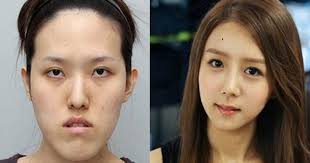 South korean eye surgery anime. 9gag On Twitter 19 Before And After Photos From Korean Plastic Surgery Makeover Show Https T Co S5pq0jh2f1