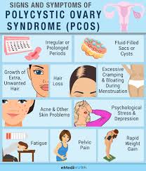 Living with pcos is not easy! Understanding Pcos Causes Symptoms And Treatment