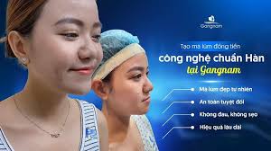 Má lúm đồng tiền là gì? Ý nghĩa tướng số của má lúm đồng tiền