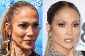 Jennifer Lopez Botox Facelift Before And After Botox Face Jennifer Lopez Plastic Surgery Facelift Before And After
