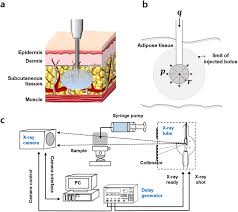 Image result for Subcutaneous Injection