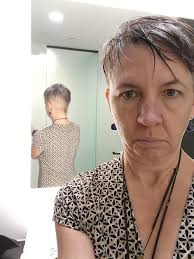 Hair loss concerns and eyebrow/eyelash anxiety