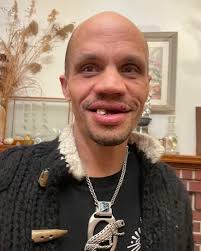 Fundraiser for David Thurston by Edward Thurston : Support David's Dental  Recovery