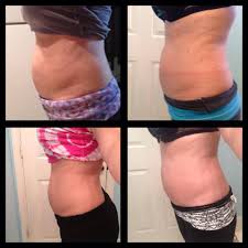 Do It Yourself Body Wrap It Works The Kitchen Prescription