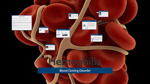 She was born february 15, 1973. Common Names For Hemophilia By Rylie Jones