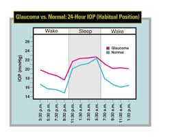 Maximizing 24 Hour Iop Control