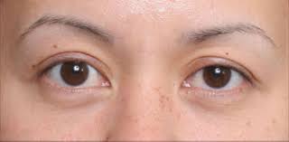 To even out the upper and lower proportions, he suggests applying dark shadow or pencil along the outer lower corner to bring down the lifted effect. Bedroom Eyes Meaning