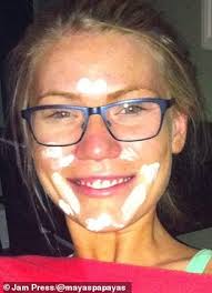 Model clears up her horrific acne with diet and meditation