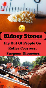 Kidney Stones Fly Out Of People On Roller Coasters Surgeon Discovers Kidney Stones Funny Kidney Stone Meme Roller Coaster