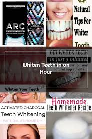 Pin On Natural Teeth Whitening