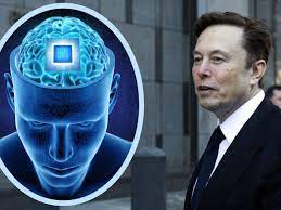 Musk-Start-up implantiert ersten Chip in menschlichem Gehirn - VOL.AT