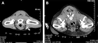 Computed Tomography Of The Musculoskeletal System Veterinary Clinics Small Animal Practice