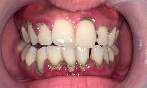 Bones Reyes Dental Clinic Home Facebook
