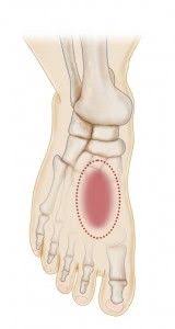 Pin On Fibromyalgia