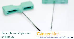 In most of the cases the bone marrow cancer does not show any there are two types of bone marrow cancer the first being the primary bone cancer and the secondary bone cancer. Bone Marrow Aspiration And Biopsy Cancer Net