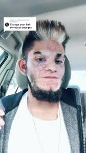 Exploring the Unique Beauty of Mohawk with Deaf and Vitiligo Representation