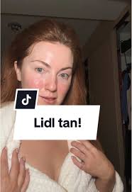 Lidl Tan Rash