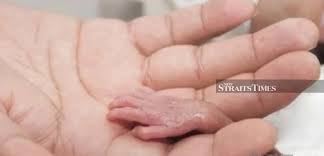Instagram abby abadi aktres abby abadi mengumumkan dirinya sudah meninggal dunia dalam sebuah kiriman instagram pagi tadi. Showbiz Please Pray For My Baby Abby Abadi