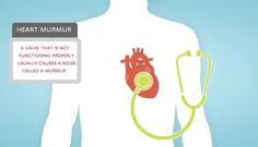 Although most heart murmurs are harmless, it's a good idea to rule out any underlying heart problems that could be serious. 83 Heart Murmur Ideas Heart Murmur Follow Your Instinct Don T Give Up