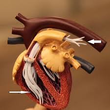 Maybe you would like to learn more about one of these? Addressing The Cost Of Heartworm In Dogs Cofund My Pet