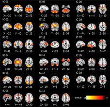 The country in which a motor vehicle's vehicle registration plate was issued may be indicated by an international licence plate country code, formerly known as an international registration letter1 or international circulation mark.2 it is referred to as the distinguishing sign of the state of registration. Intrinsic Resting State Networks Rsn Saggital Coronal And Transverse Download Scientific Diagram