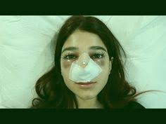 شو صار بعد عملية أنفي Funny Images Beauty Image